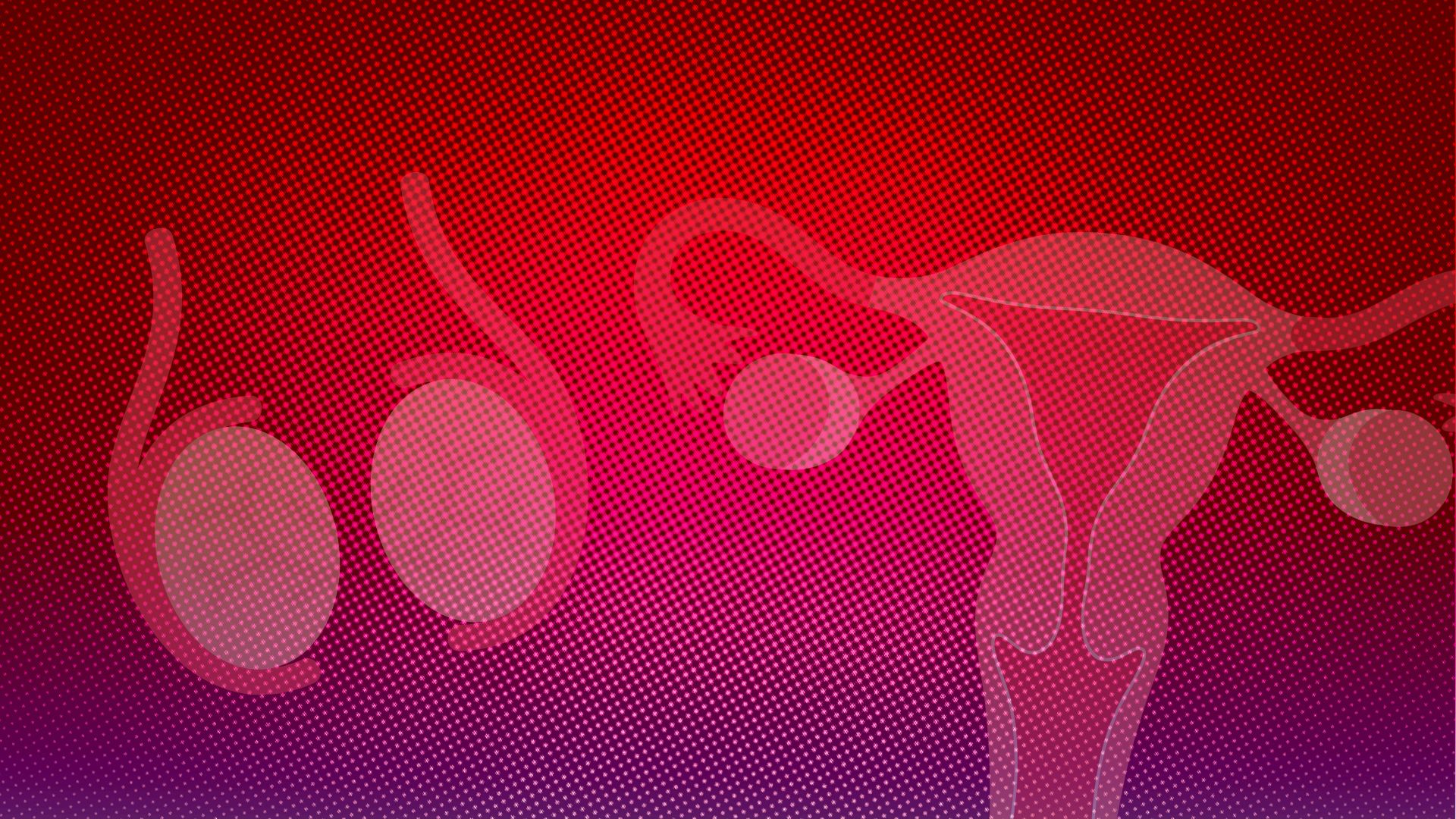 Myths About Permanent Contraception